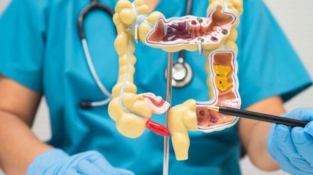 ¿Cuáles son las 5 enfermedades del sistema digestivo?